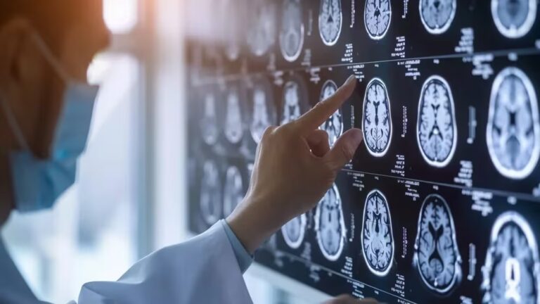 Avance contra el cáncer: científicos mapearon las capas que componen a los tumores cerebrales